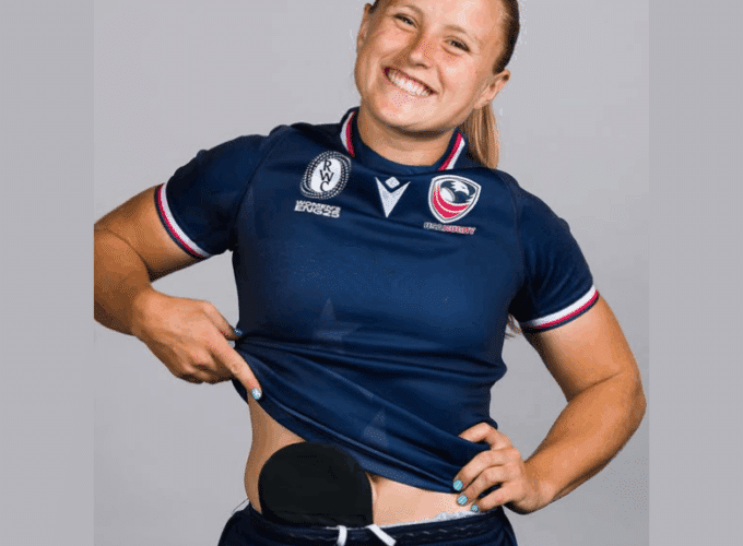 Cassidy Bargell wearing rugby kit, smiling and showing stoma bag